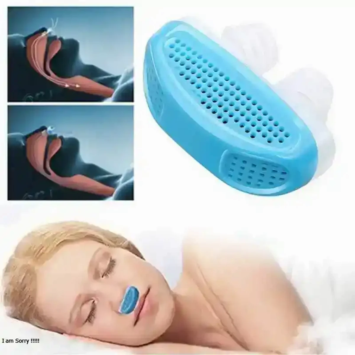 নাক ডাকার মেশিন ANTI SNORING DEVICE